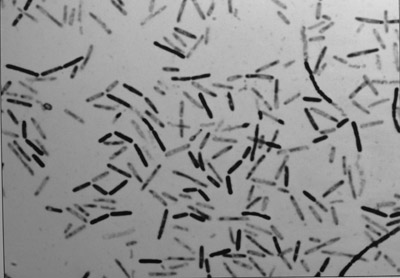 Sporenbacterie inactiev sporenbacterie Foto: CDI lelystad